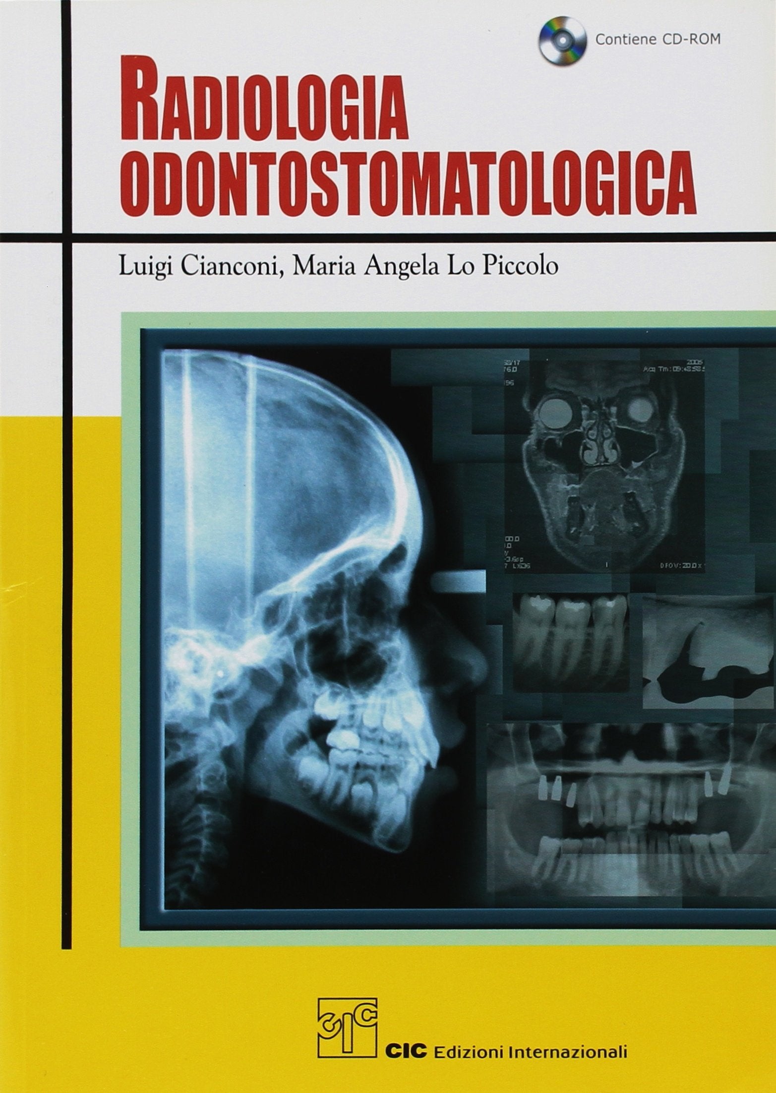 Radiologia odontostomatologica. Con CD-ROM Medicine