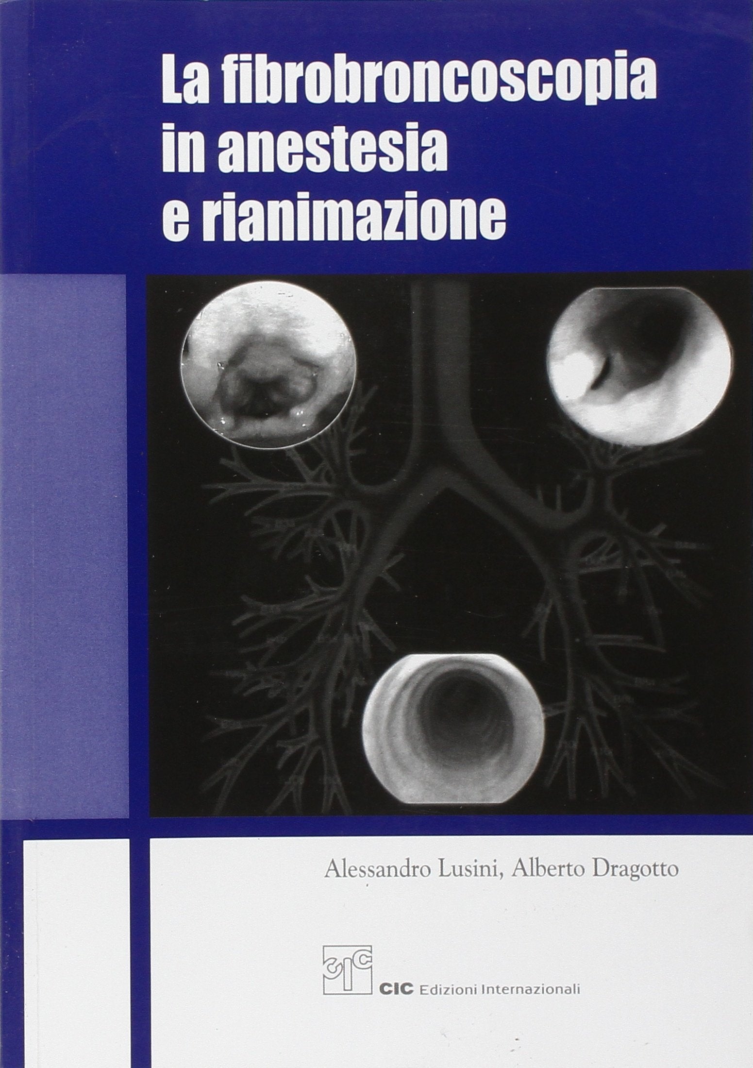 La fibrobroncoscopia in anestesia e rianimazione Medicine