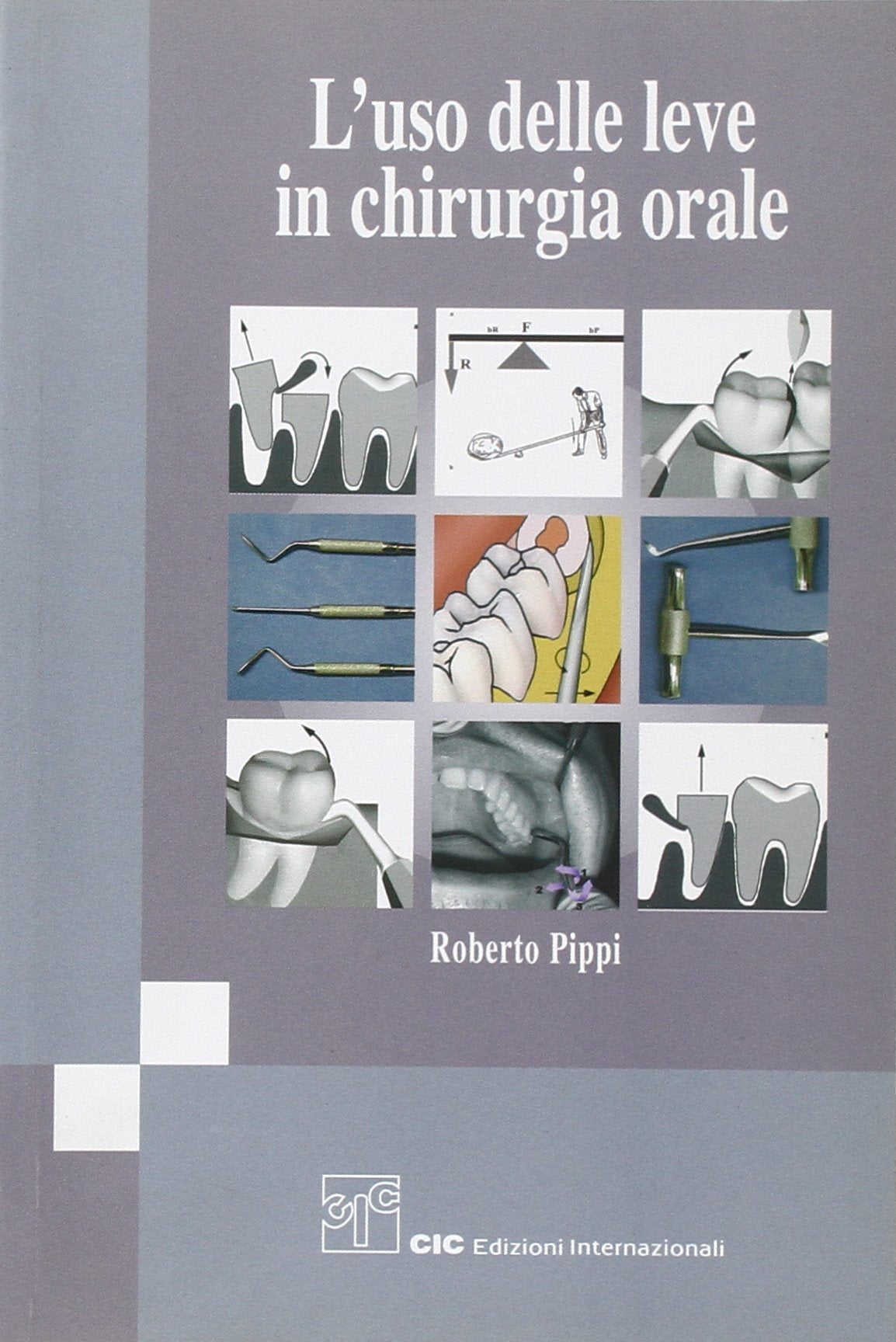 L'uso delle leve in chirurgia orale. Ediz. illustrata Medicine