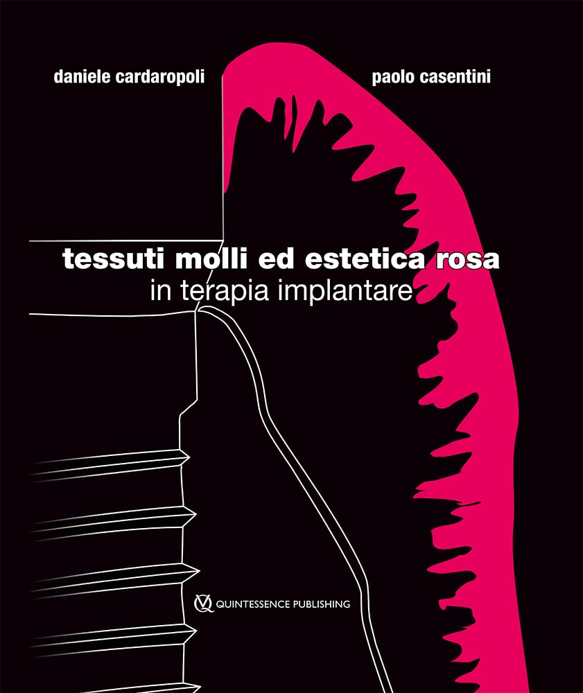 Tessuti molli ed estetica rosa in terapia implantare Medicine
