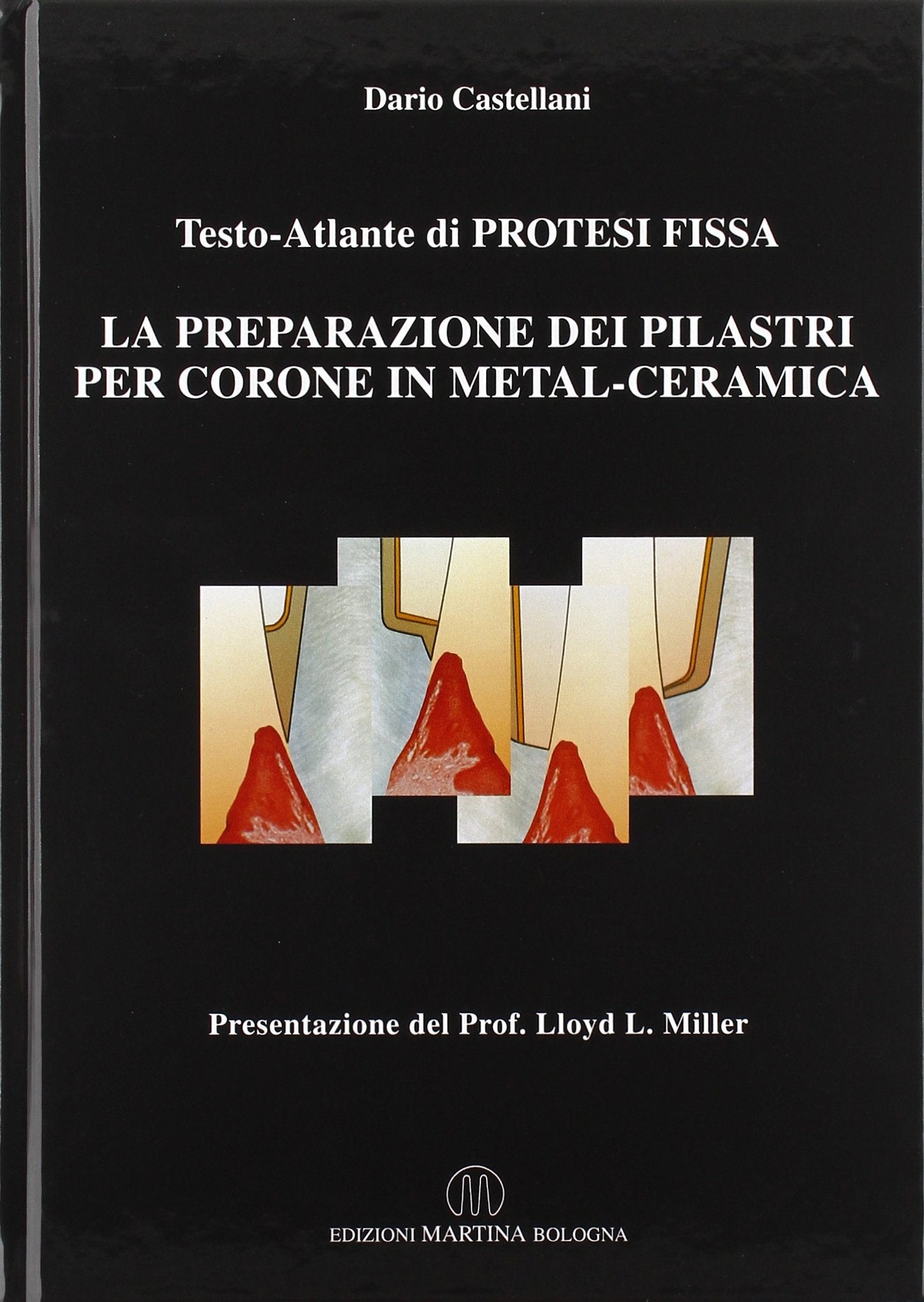Atlante di protesi fissa. Per corone e ponti in metal-ceramica book