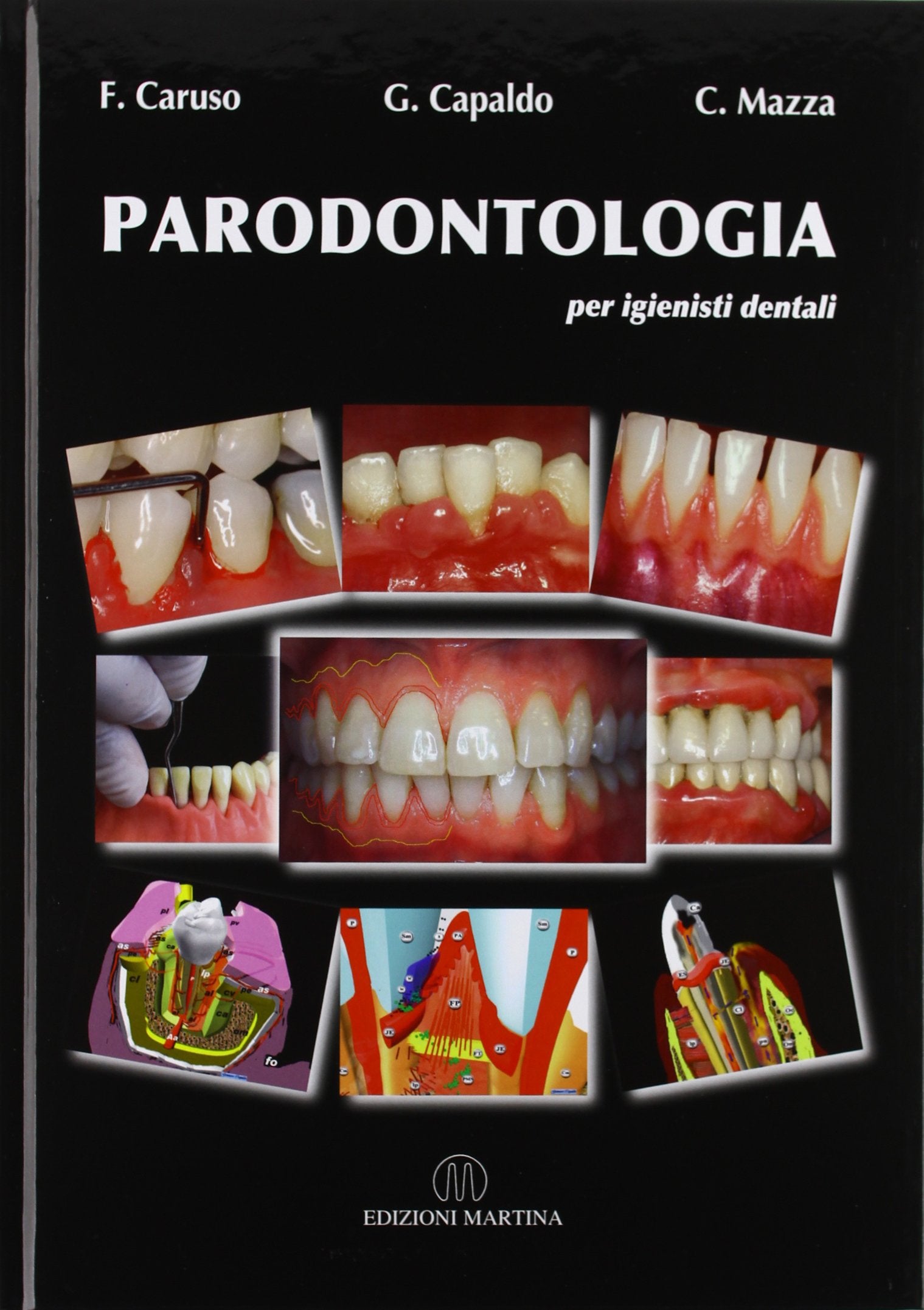 Parodontologia per igienisti dentali book