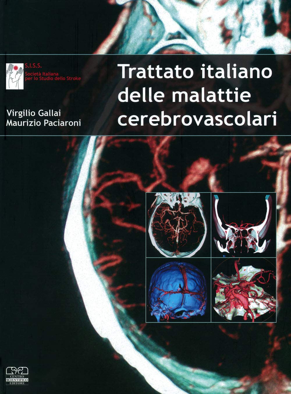 Trattato italiano delle malattie cerebrovascolari book