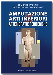 Amputazione degli arti inferiori nelle arteriopatie periferiche (Specialità mediche) Medicine