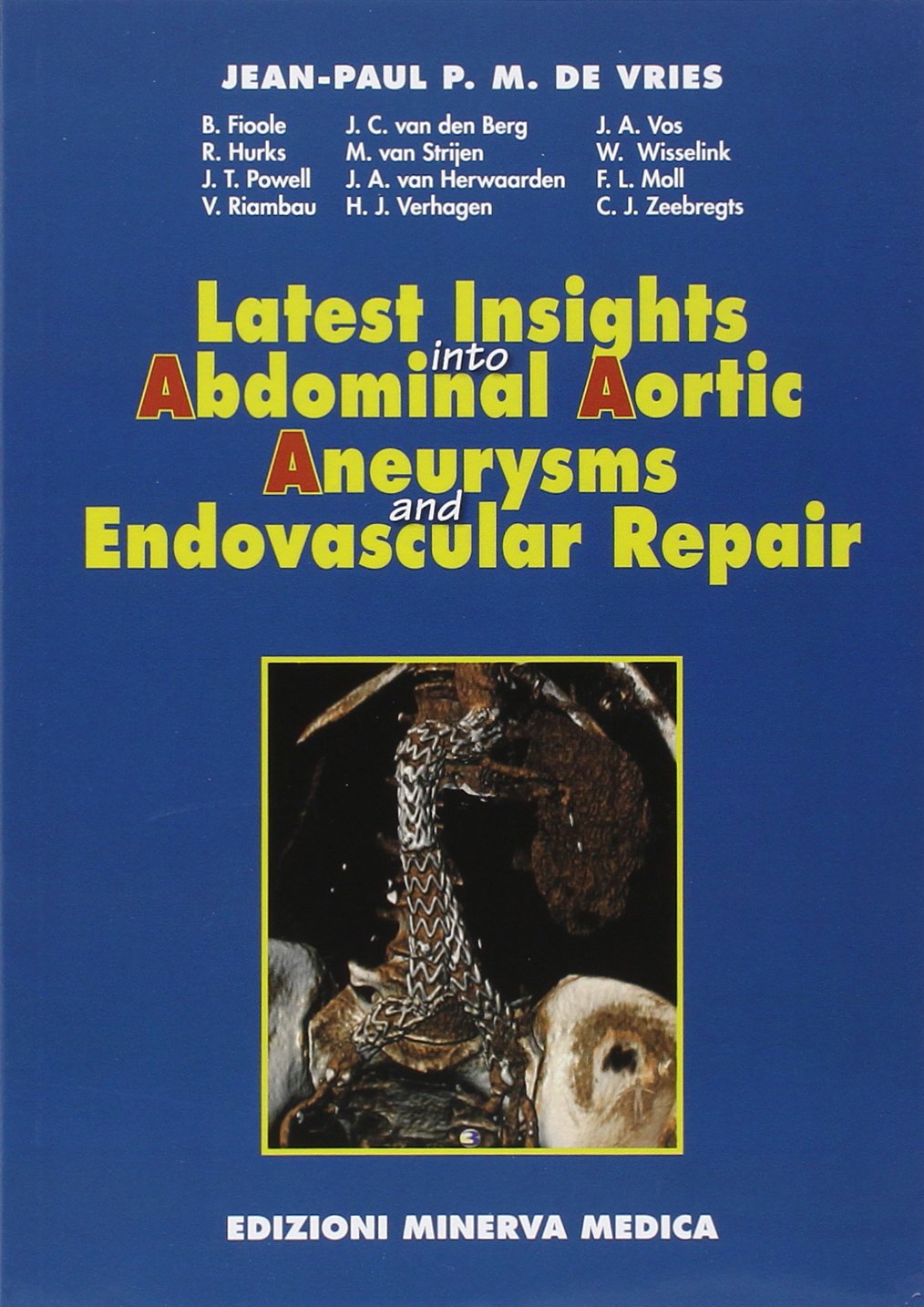 Latest Insights into Abdominal Aortic Aneurysms and Endovascular Repair Medicine