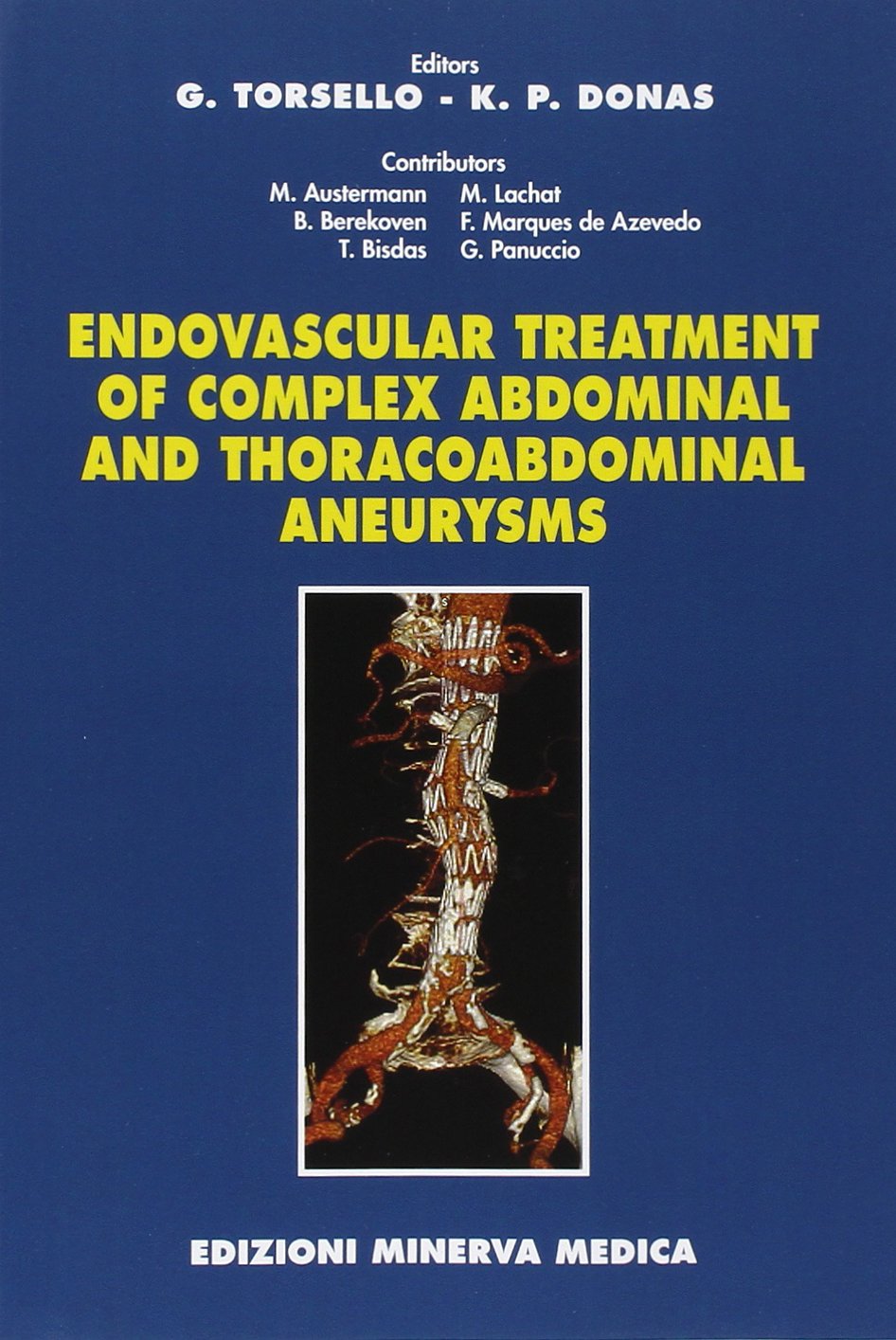 Endovascular Treatment of Complex Abdominal and Thoracoabdominal Aneurysms Medicine