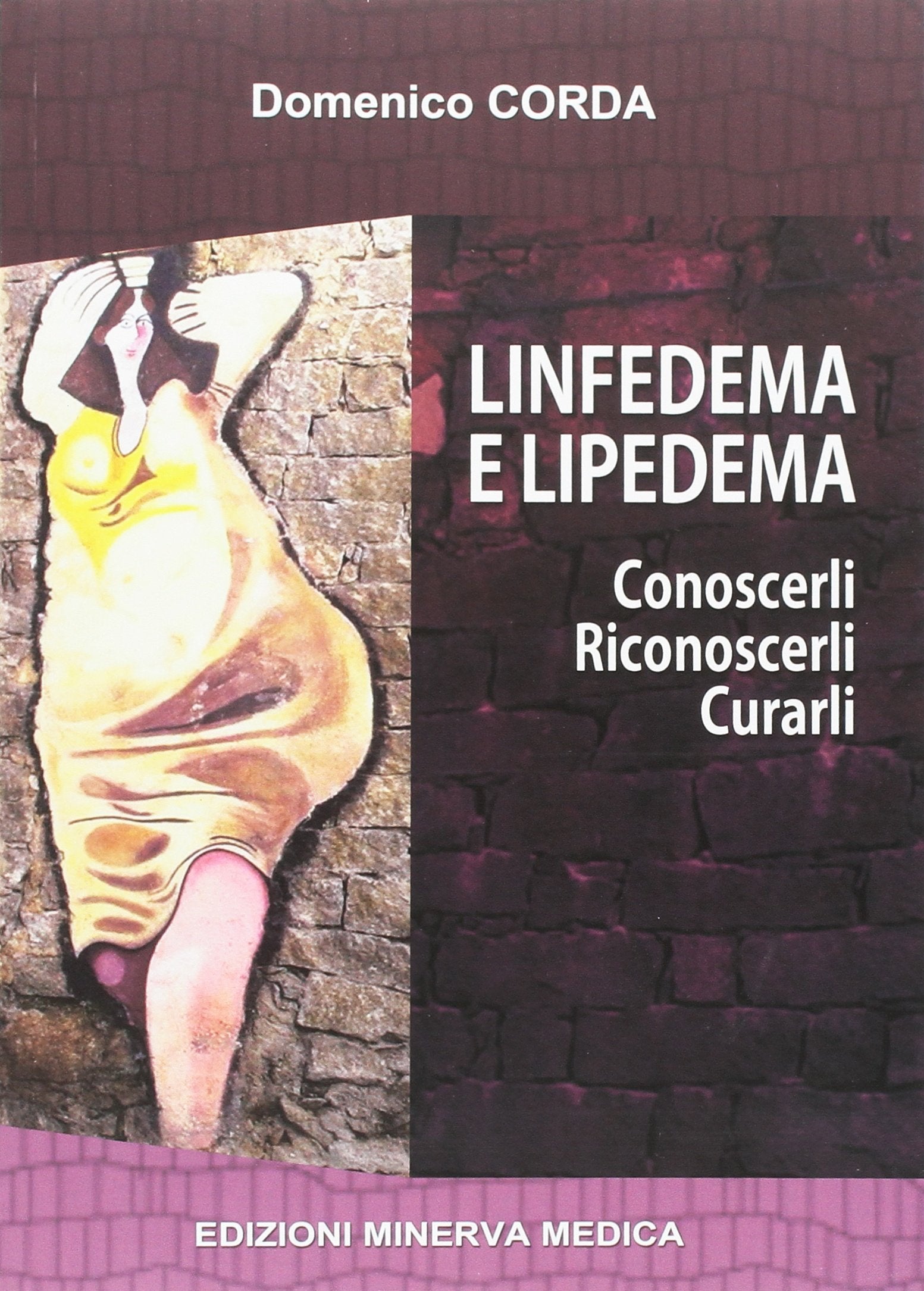Linfedema e lipedema. Conoscerli. Riconoscerli. Curarli book