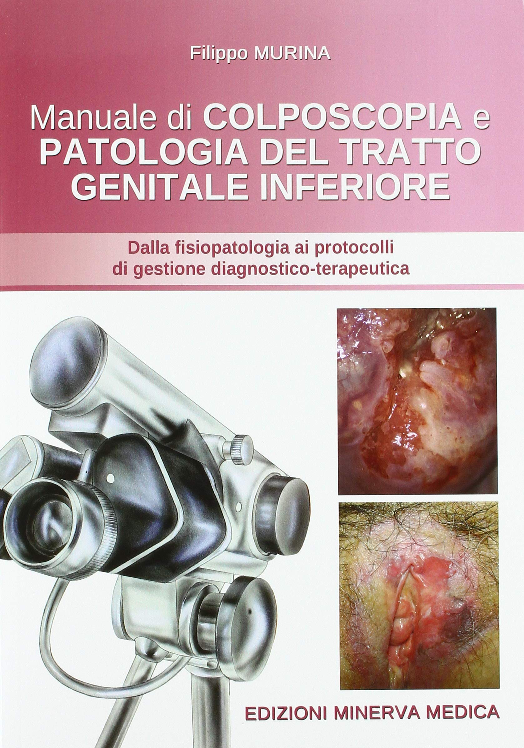 Manuale di colposcopia e patologia del tratto genitale inferiore. Dalla fisiologia ai protocolli di gestione diagnostico-terapeutica book