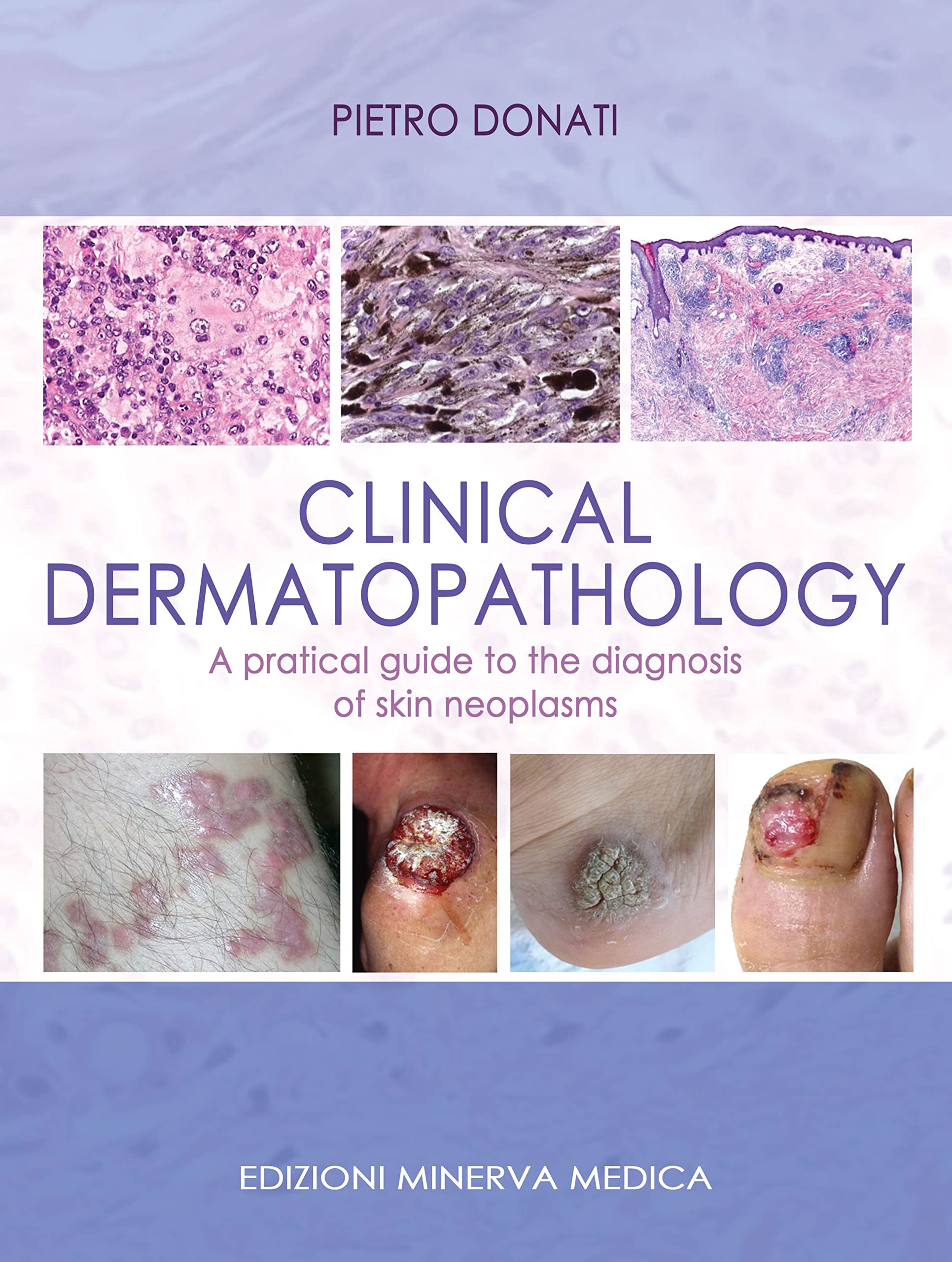 Clinical dermatopathology. A pratical guide to the diagnosis of skin neoplasms Medicine