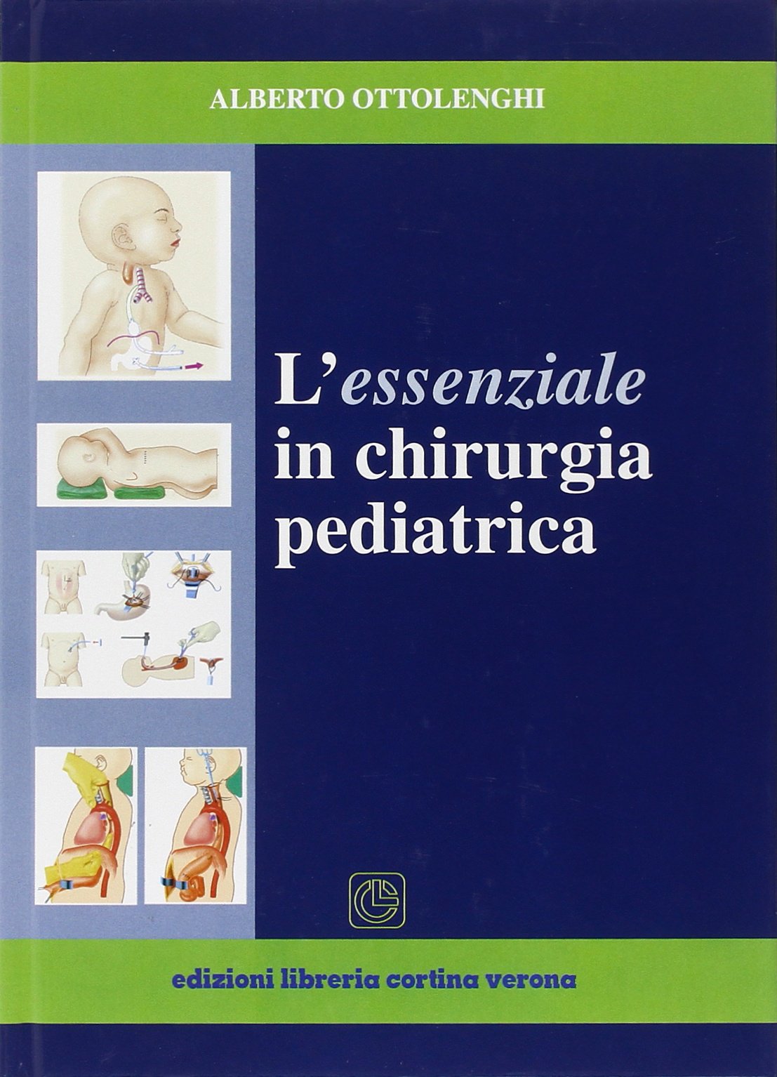 L'essenziale in chirurgia pediatrica book
