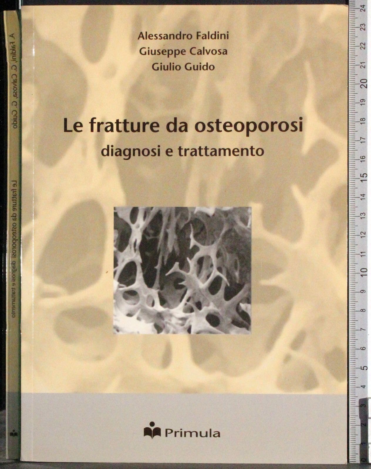 Le fratture da osteoporosi. Diagnosi e trattamento Medicine