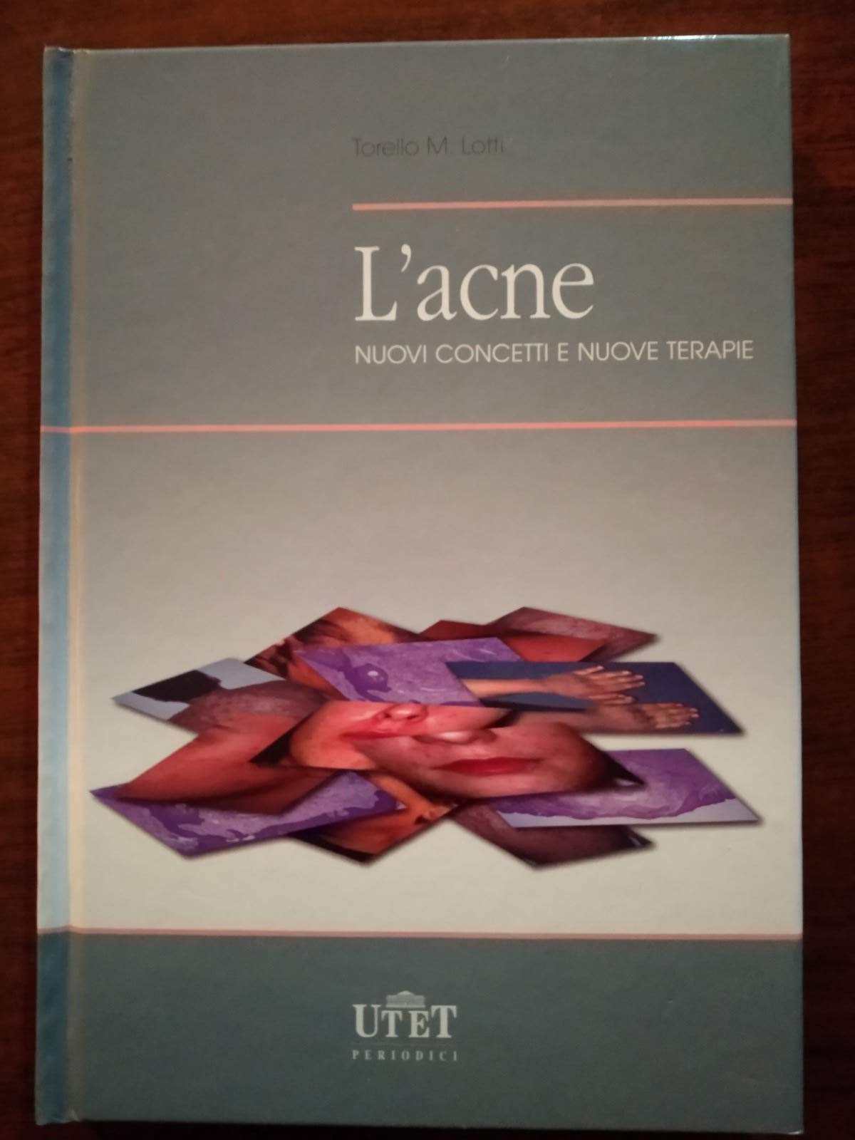 L'acne. Nuovi concetti e nuove terapie book