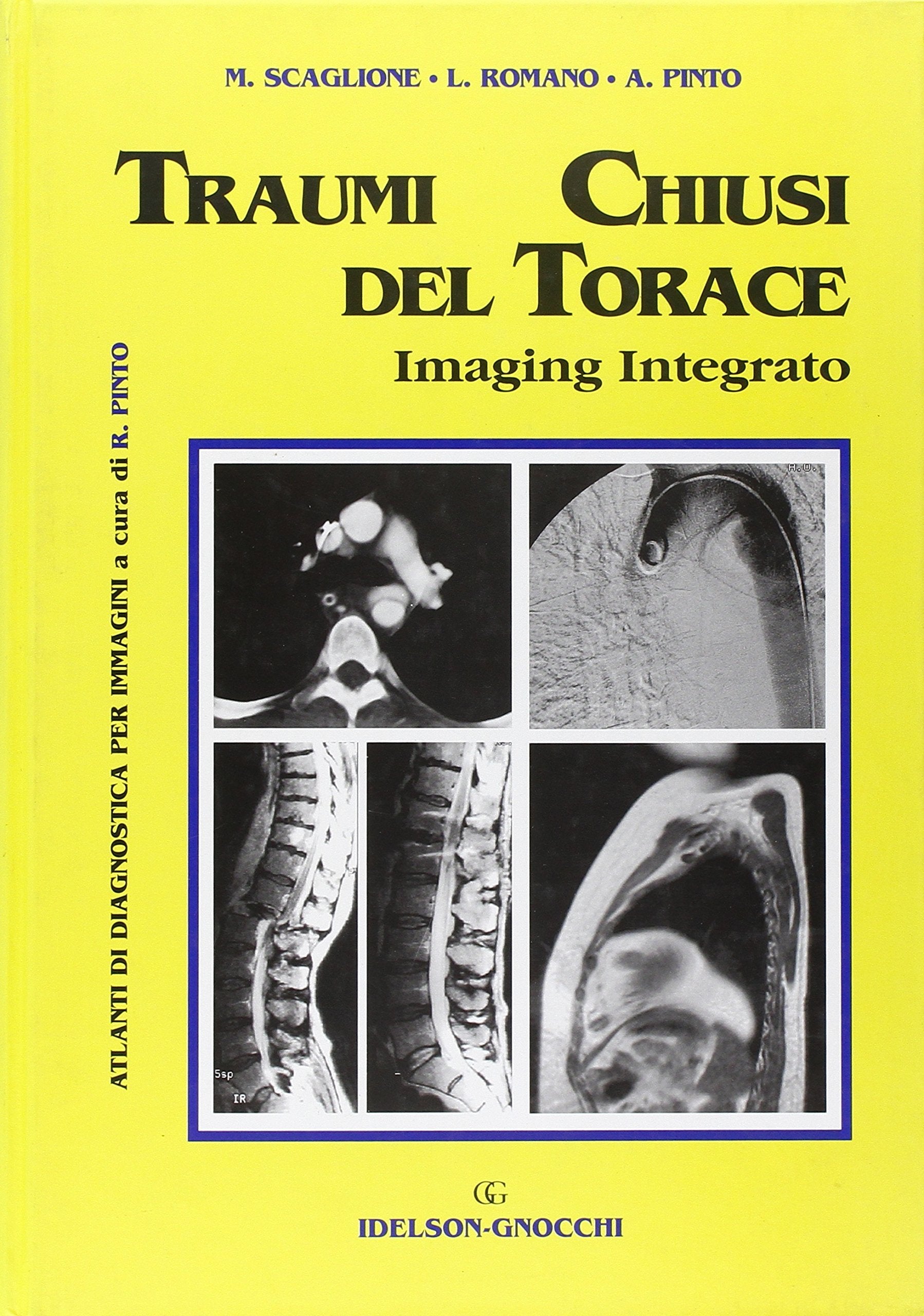 Traumi chiusi del torace. Imaging integrato book