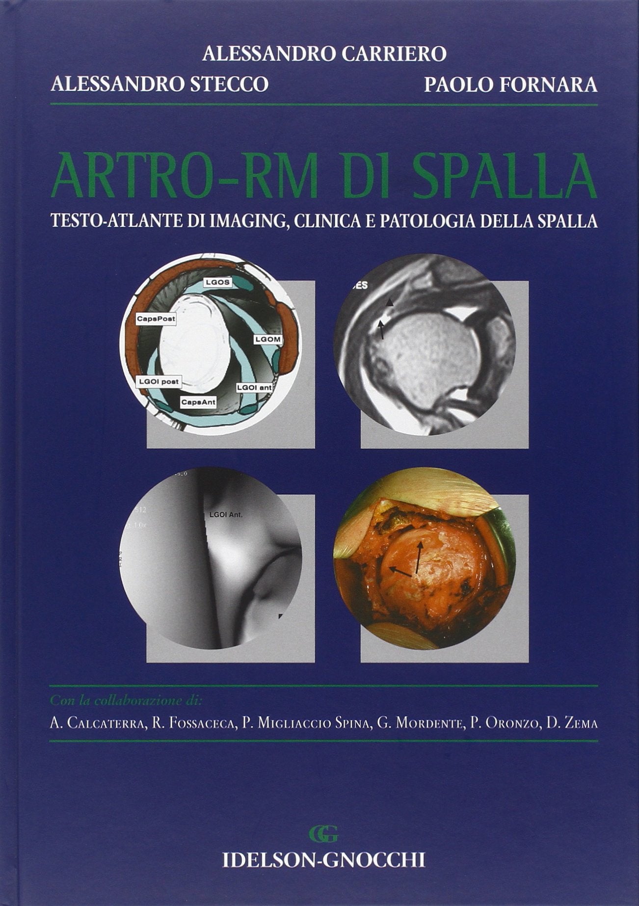 Artro-RM di spalla. Testo atlante di imaging, clinica e patologia della spalla book