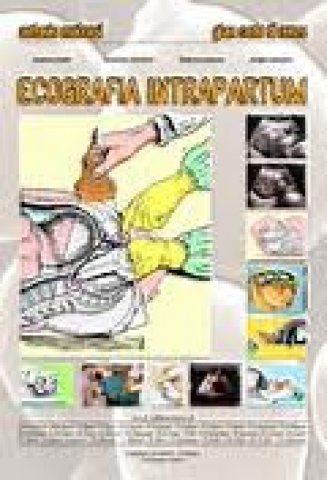 Ecografia intrapartum (Universitaria) Medicine
