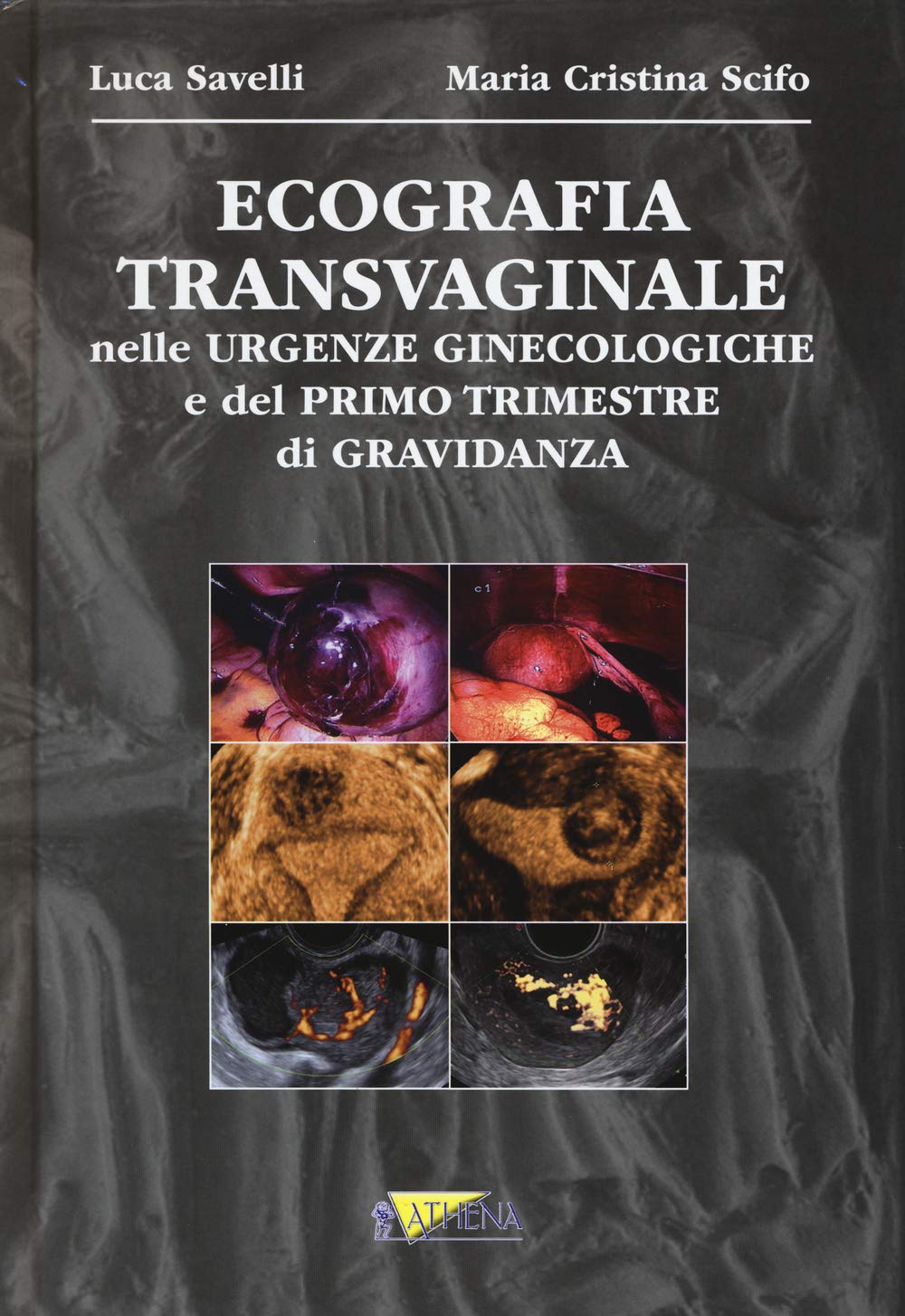 Ecografia transvaginale nelle urgenze ginecologiche e del primo trimestre di gravidanza Medicine