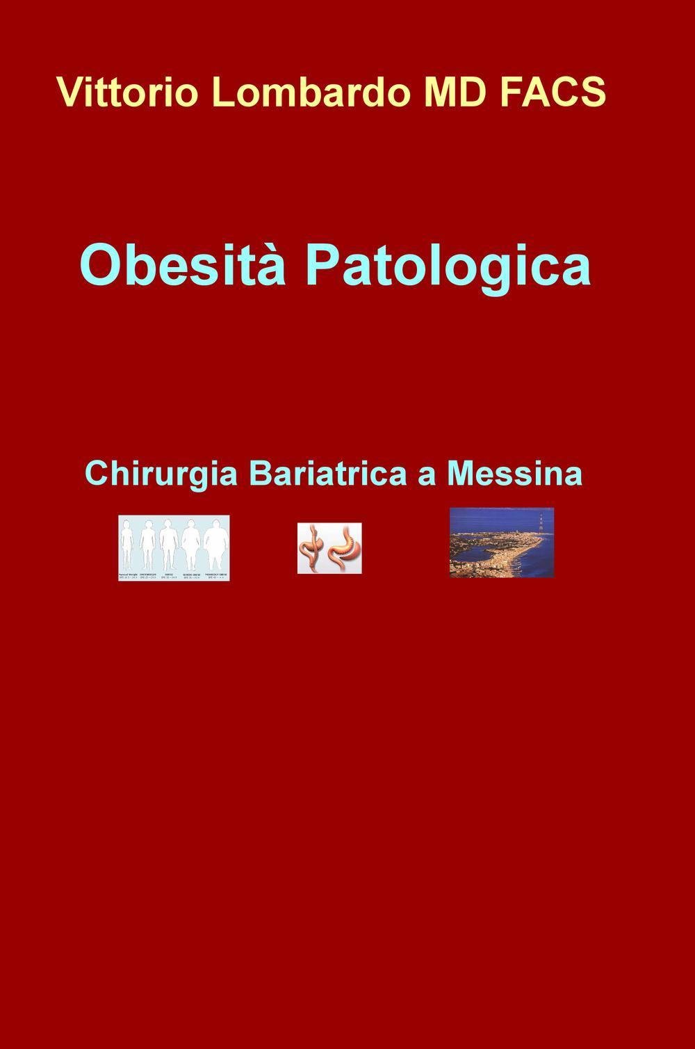 Obesità patologica. Chirurgia bariatrica a Messina Medicine