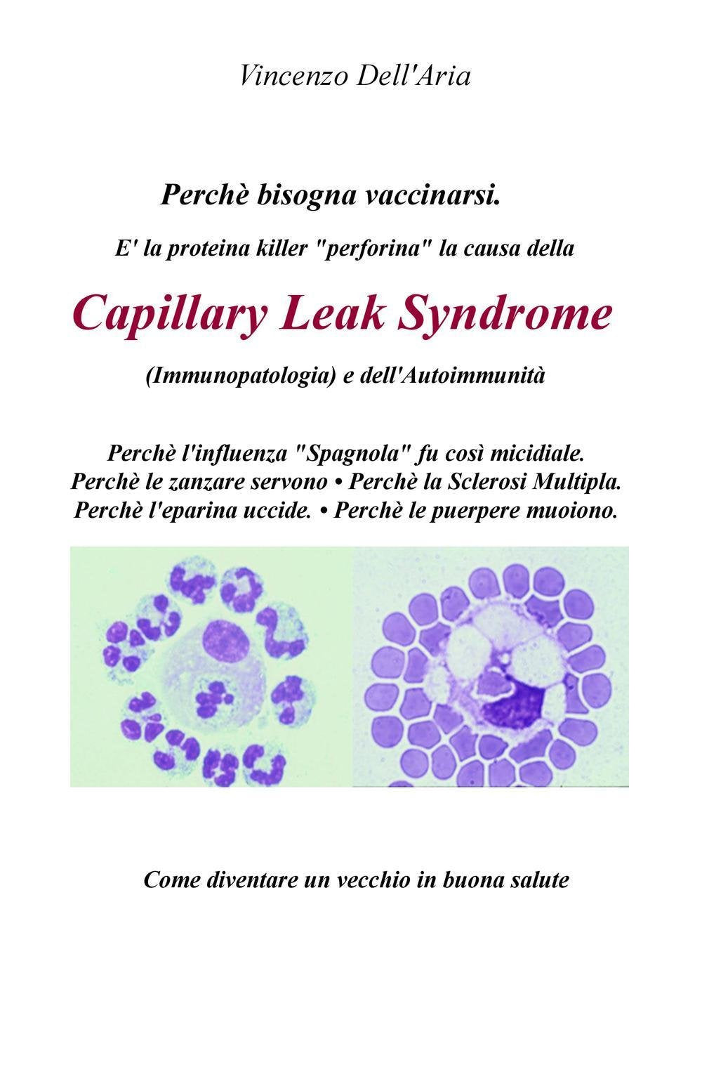 E' la proteina killer “perforina” la causa della Capillary Leak Syndrome (Immunopatologia) e dell'Autoimmunità (La community di ilmiolibro.it) Medicine