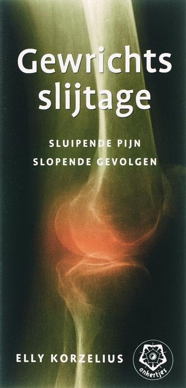 Gewrichtsslijtage: sluipende pijn, slopende gevolgen book