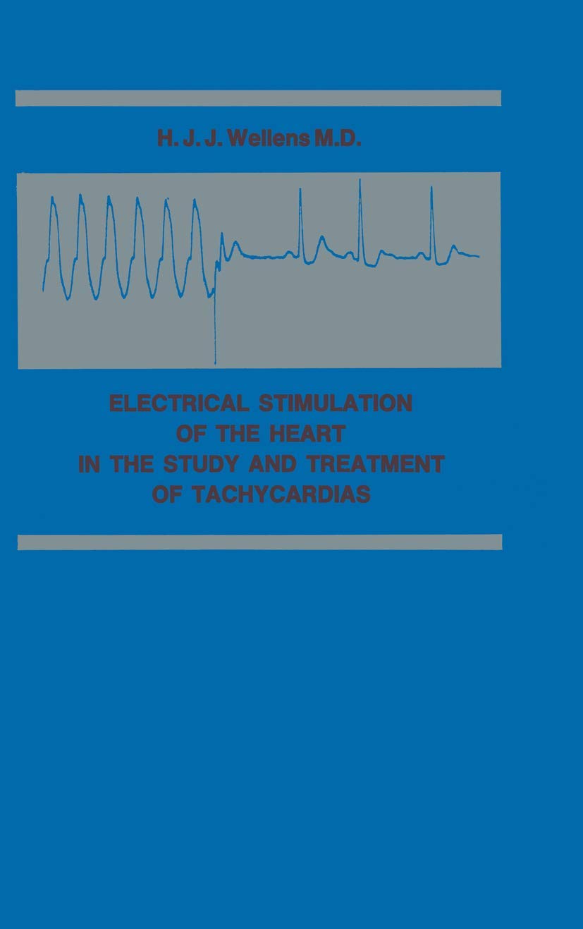 Electrical Stimulation of the Heart in the Study and Treatment of Tachycardias Medicine