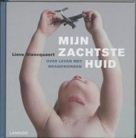 Mijn zachtste huid: Over leven met brandwonden book
