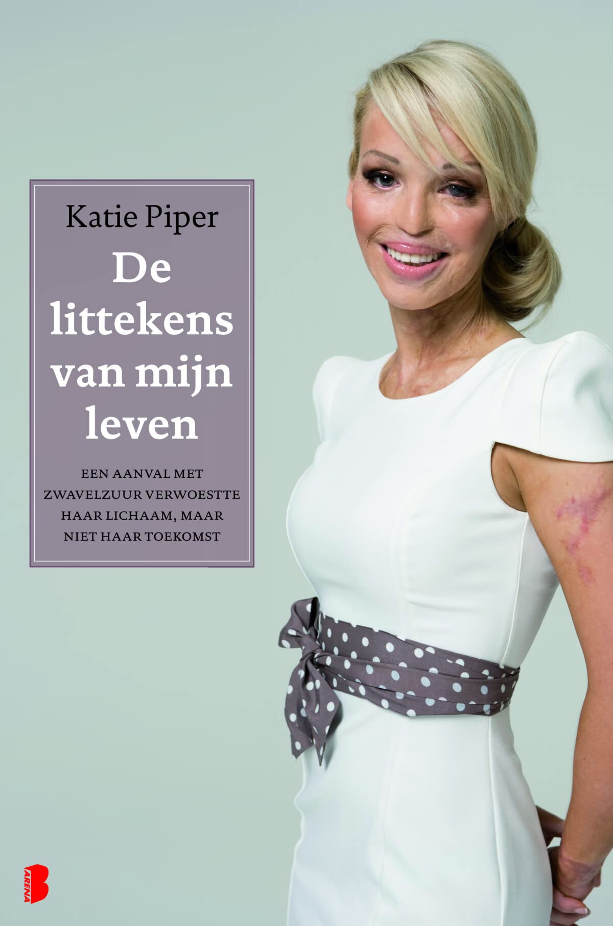De littekens van mijn leven: Een aanval met zwavelzuur verwoestte haar lichaam, maar niet haar toekomst book