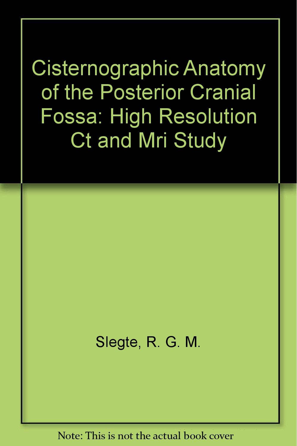 Cisternographic Anatomy of the Posterior Cranial Fossa: High Resolution Ct and Mri Study book