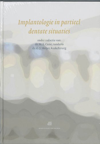 Implantologie in partieel dentate situaties book