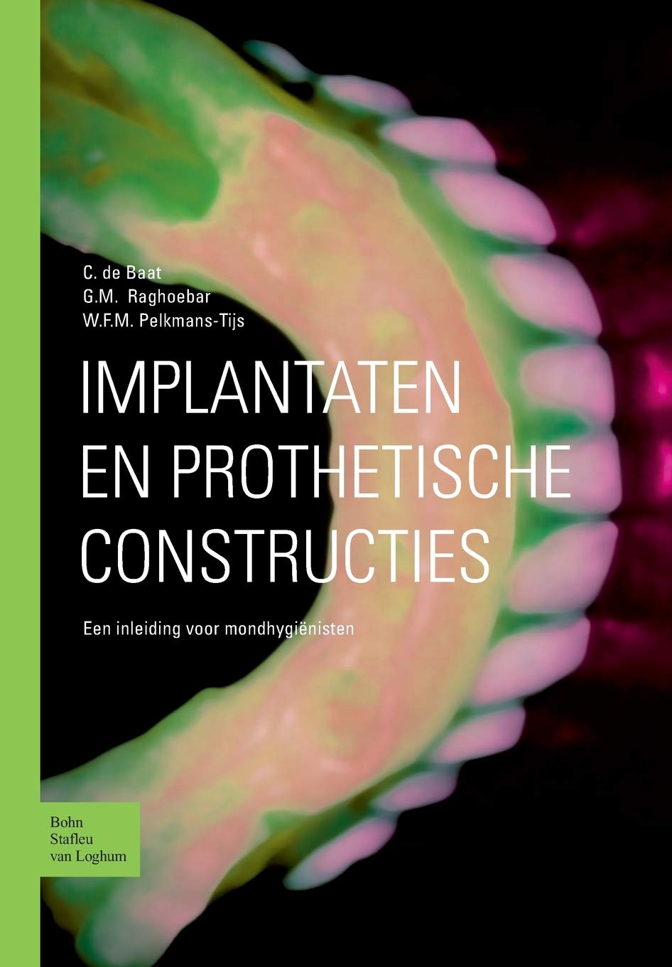 Implantaten En Prothetische Constructies: Een Inleiding Voor Mondhygiënisten book