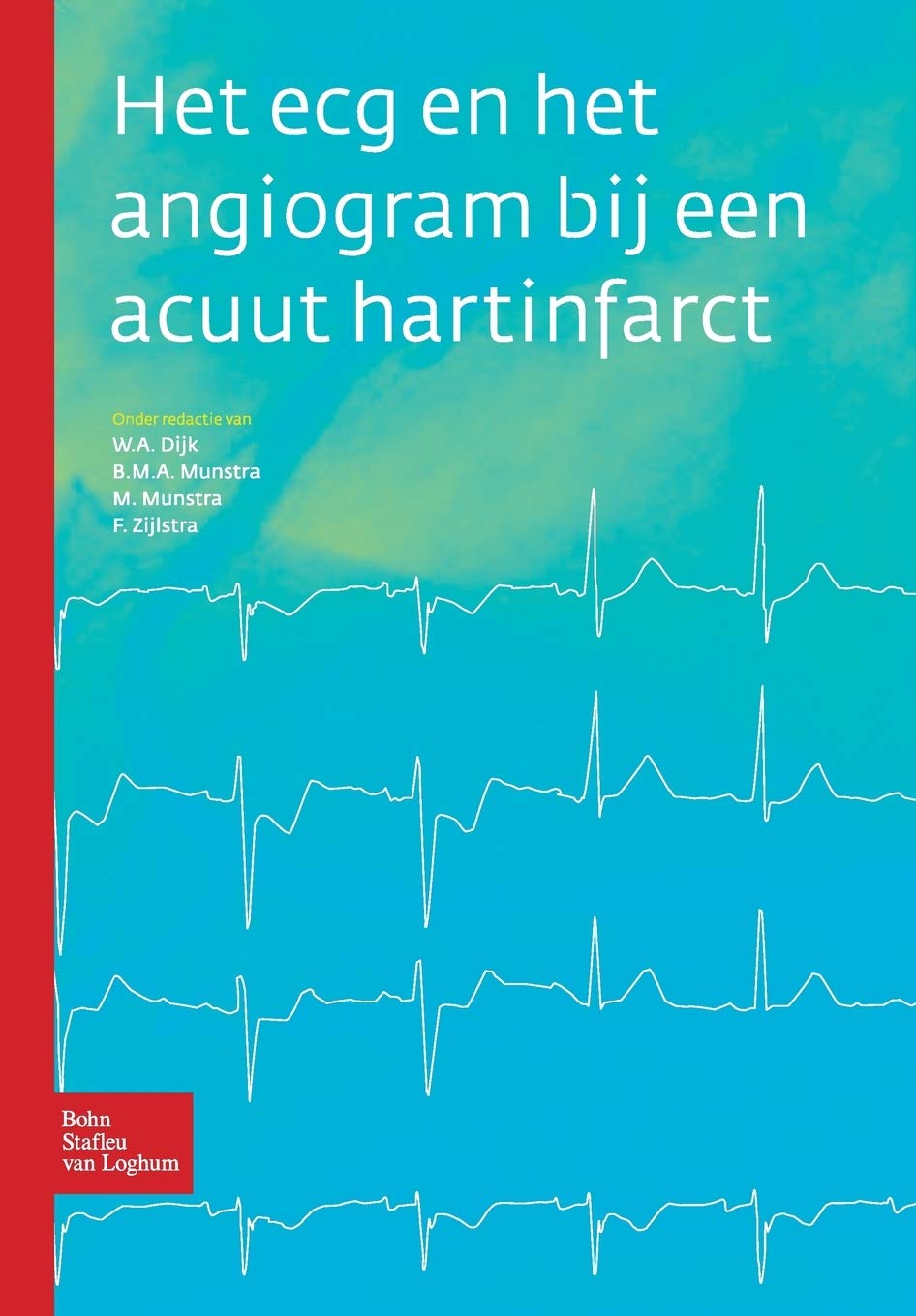 Het ECG En Het Angiogram Bij Een Acuut Hartinfarct book