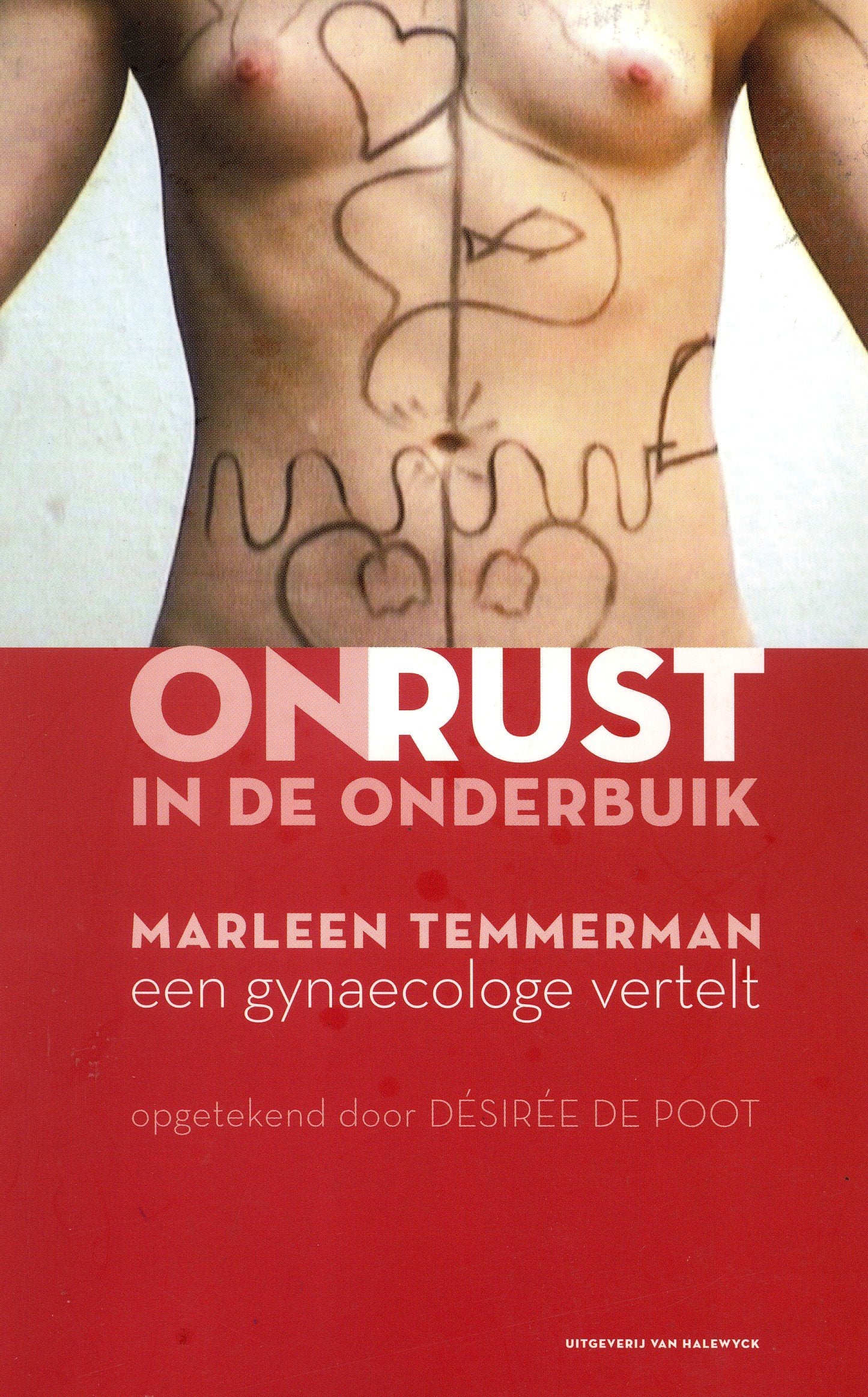 Onrust in de onderbuik: Een gynaecologe vertelt Medicine