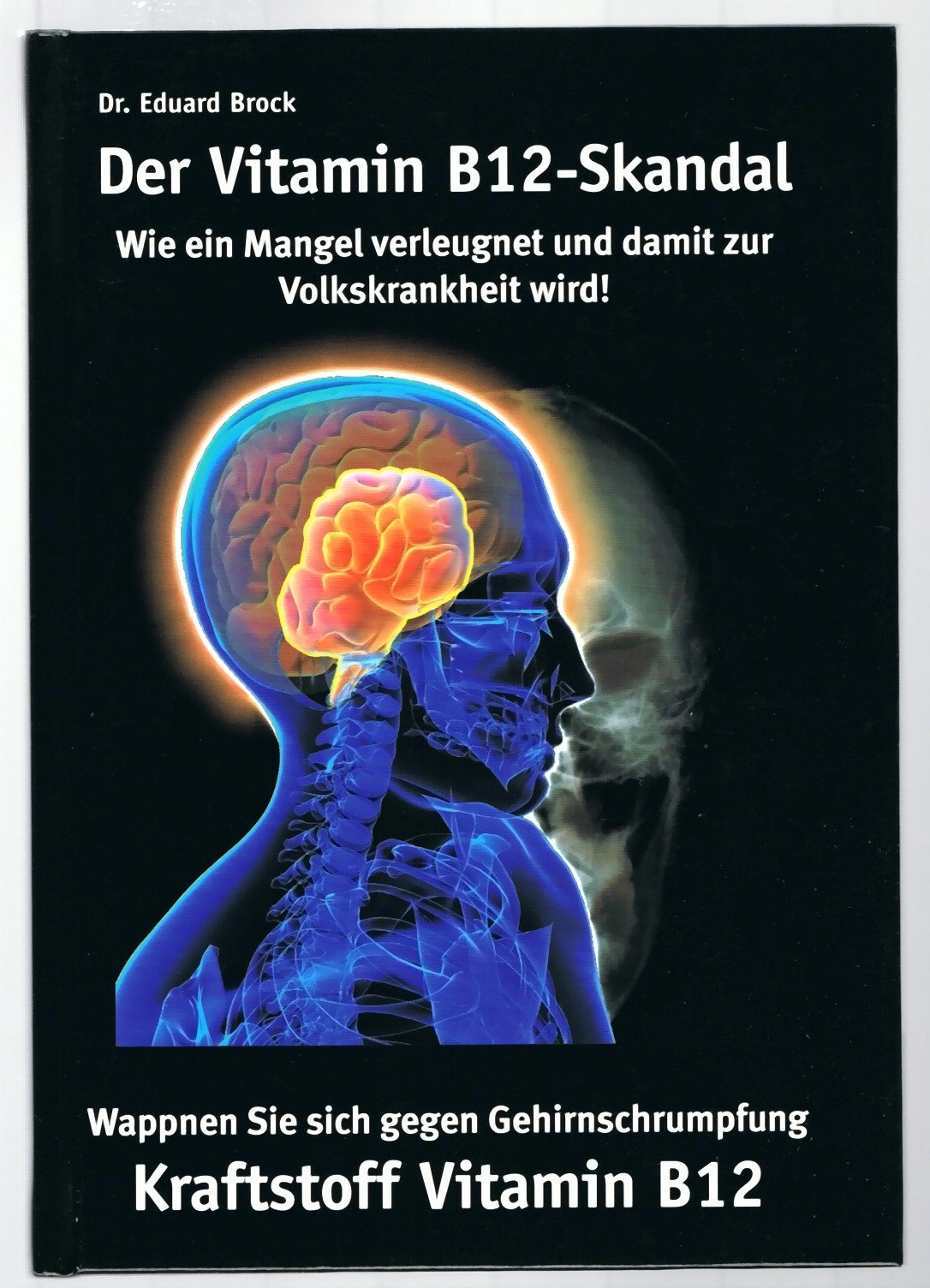 Der Vitamin B12 - Skandal. Wie ein Mangel verleugnet und damit zur Volkskrankheit wird Books