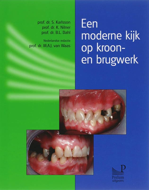 Een moderne kijk op kroon- en brugwerk book