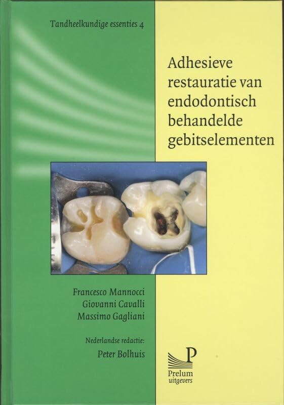 Adhesieve restauratie van endodontisch behandelde gebitselementen (Tandheelkundige essenties, 4) Medicine