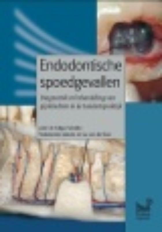 Endodontische spoedgevallen: diagnostiek en behandeling van pijnklachten in de tandartspraktijk book