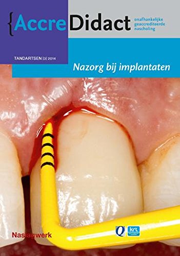 Nazorg bij implantaten: naslagwerk bij de onlinecursus book