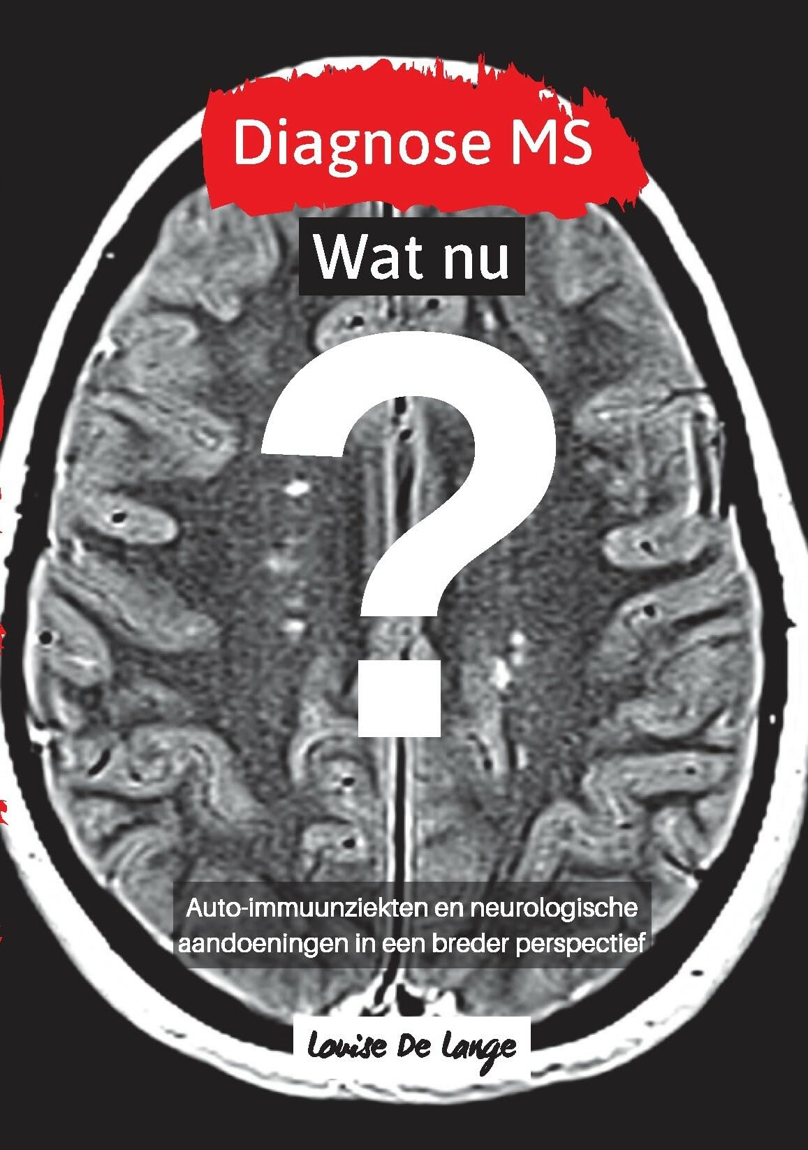 Diagnose MS: wat nu? auto-immuunziekten en neurologische aandoeningen in een breder perspectief book