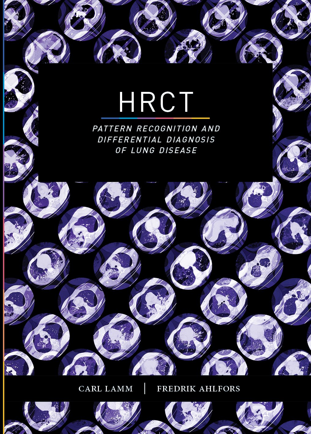 HRCT : pattern recognition and differential diagnosis of lung disease Books
