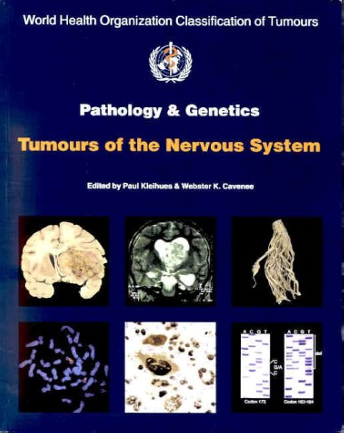 Pathology and Genetics of Tumours of the Nervous System book