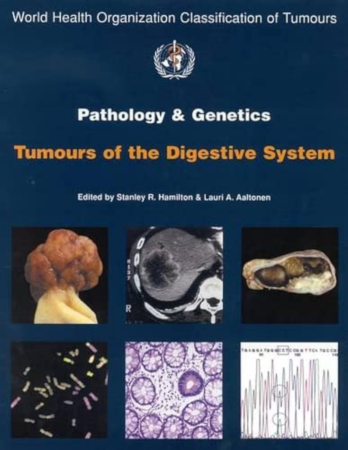 World Health Organization Classification of Tumours: Pathology and Genetics of Tumours of the Digestive System (Iarc Scientific Publications) Medicine
