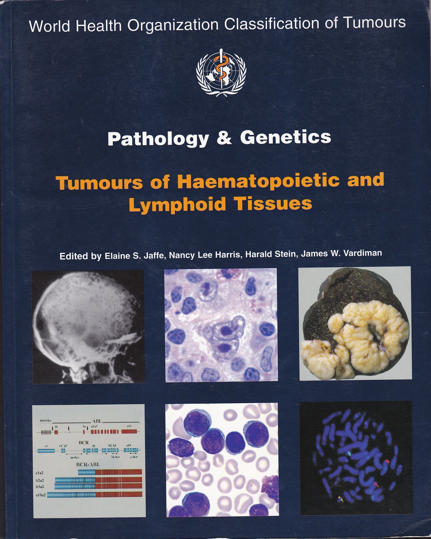 Pathology and Genetics of Haemo (World Health Organization Classification of Tumours, Band 3) Medicine