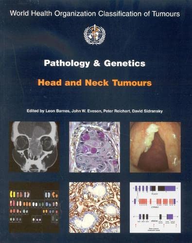 Pathology and Genetics of Head and Neck Tumours Medicine