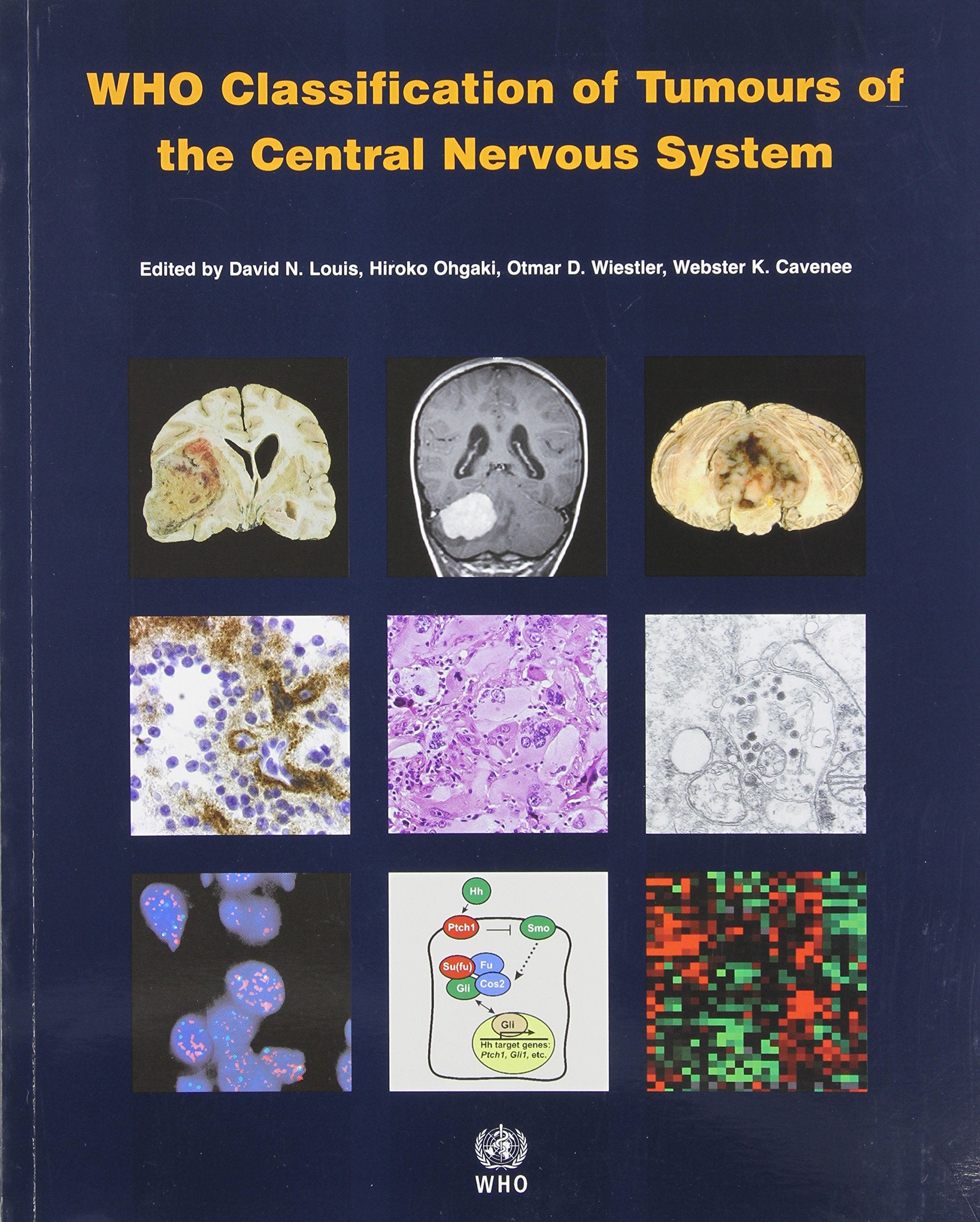 Who Classification of Tumours of the Central Nervous System book