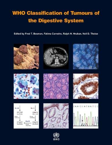 WHO Classification of Tumours of the Digestive System Medicine