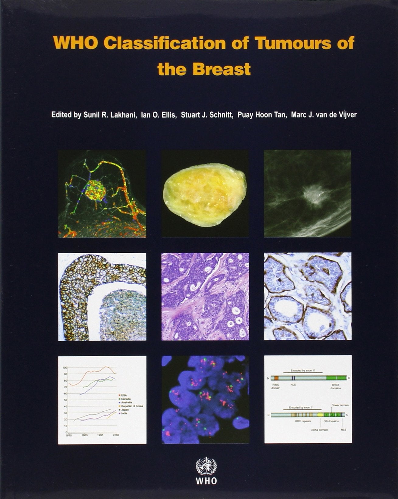 Who Classification of Tumours of the Breast [op] Medicine