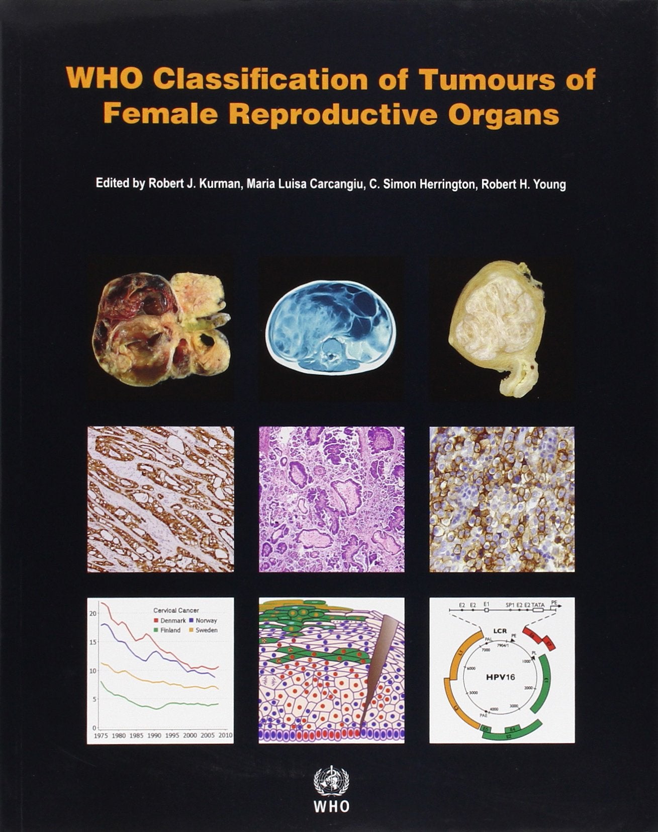 WHO Classification of Tumours of Female Reproductive Organs book