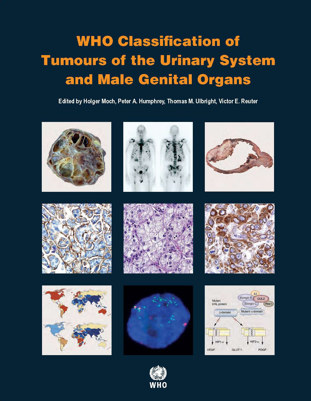 WHO Classification of Tumours of the Urinary System and Male Genital Organs (World Health Organization Classification of Tumours, Band 8) Medicine