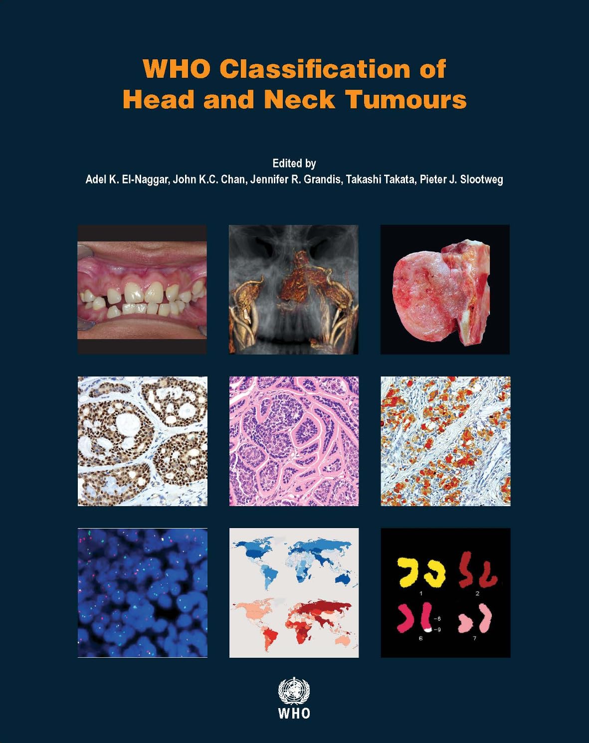 WHO Classification of Head and Neck Tumours (World Health Organization Classification of Tumours) Medicine