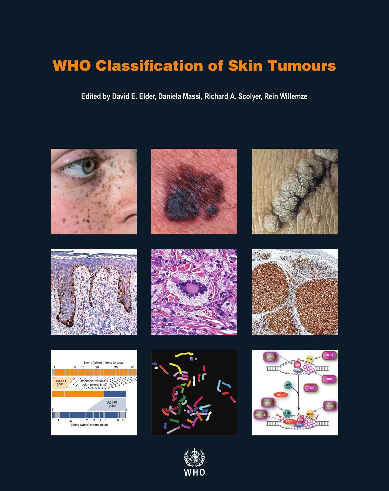 Who Classification of Skin Tumours: WHO Classification of Tumours, Volume 11 (Who Classification of Tumours: International Agency for Research on Cancer, Band 11) Medicine