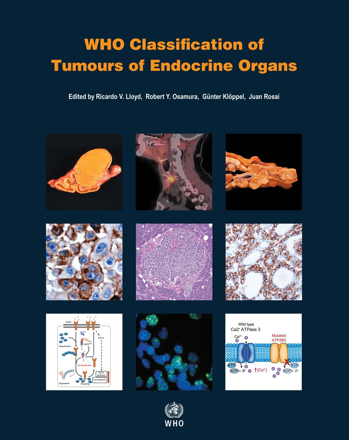 Who Classification of Tumours of Endocrine Organs Medicine